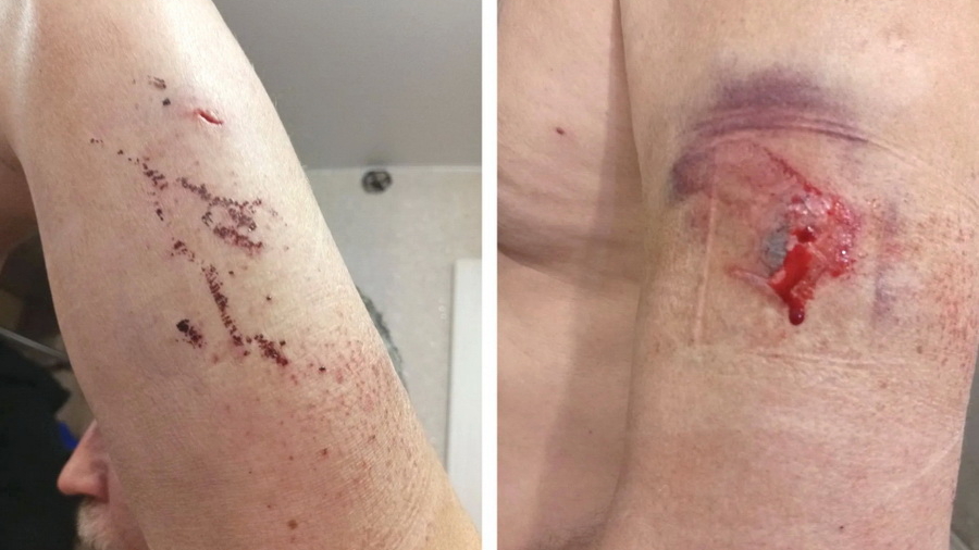 Туристы из Сочи стреляли в дальнобойщика остановившегося попить кофе в Сростках