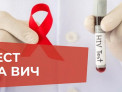 Жители Белокурихи 19 мая смогут бесплатно сдать экспресс-тест на ВИЧ