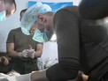 Российские военные медики разработали технологию полного восстановления конечностей после ранений